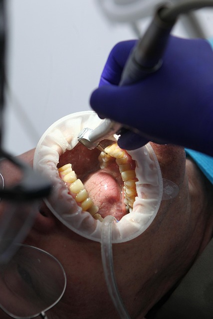 Professional dental care at Purple Rain Dental Clinic - skilled treatment in a clinical setting